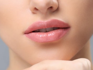 Lip Lift - IFT