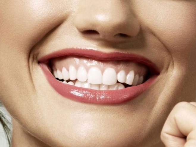Sorriso Gengival - IFT